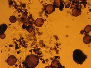 Крахмальные грануды под микроскопом