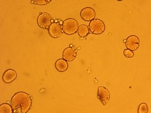 Крахмальные грануды под микроскопом
